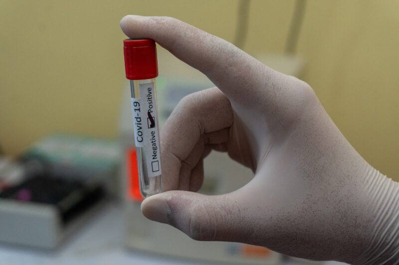 protocolli vaccini